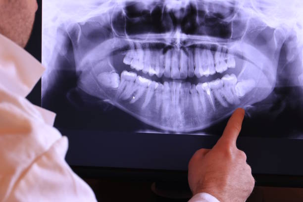 Best Emergency Dental Filling Replacement  in Flat Rock, NC