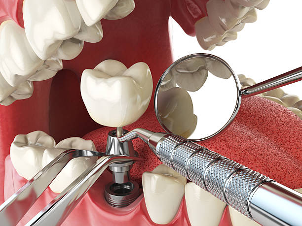 Best Cracked Tooth Emergency Dentist  in Flat Rock, NC